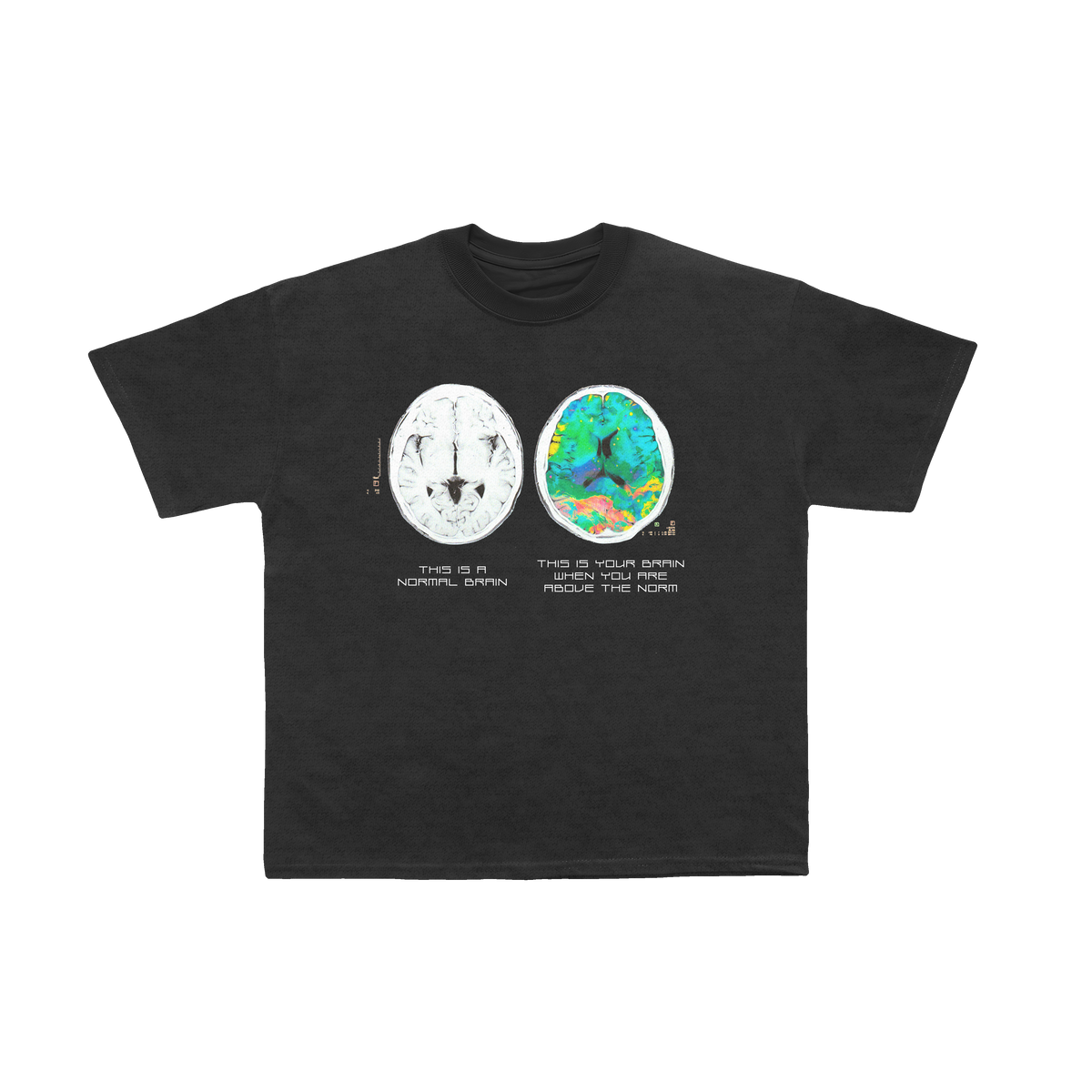 Brain on ATN Tee