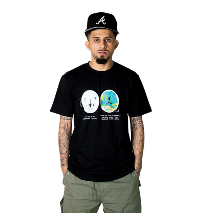 Brain on ATN Tee