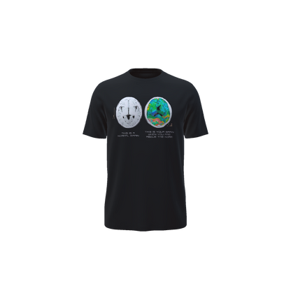 Brain on ATN Tee